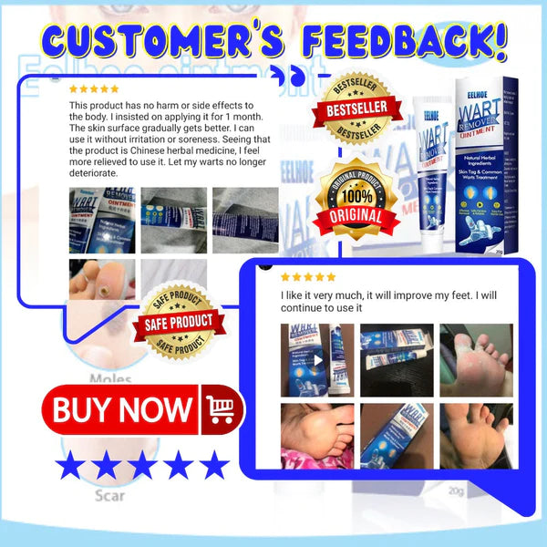 Herbal Wart Treatment Cream【3 Day Delivery&Cash on delivery】