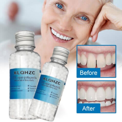 Dental restoration filling gel