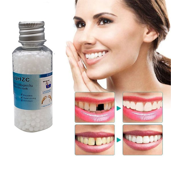Dental restoration filling gel