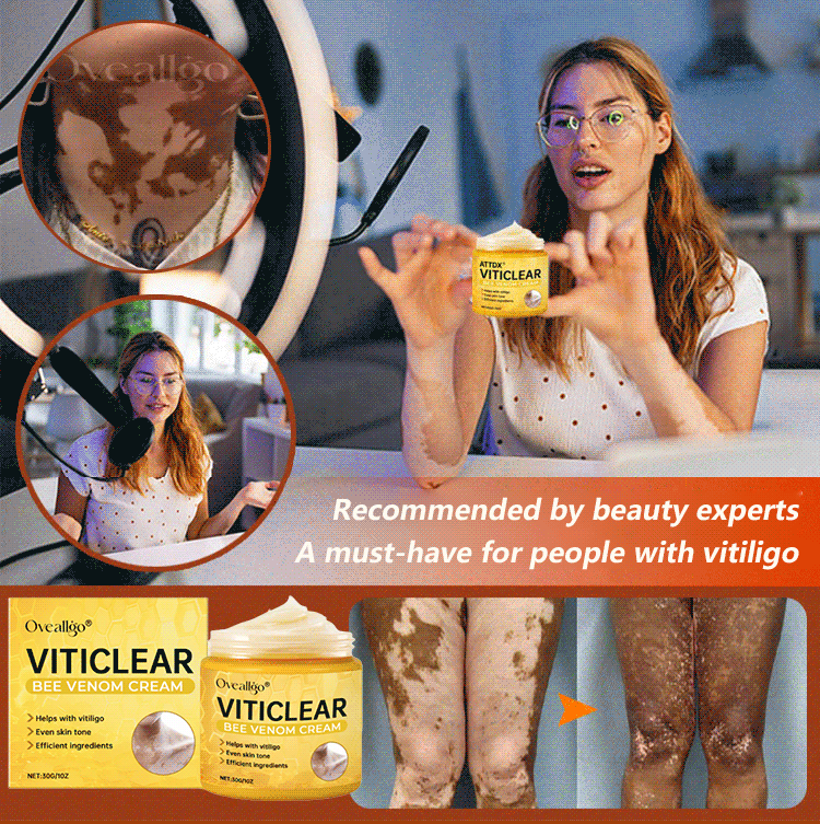 【🎌From japan🎌】Bee Venom Vitiligo Herbal Body Cream🔥LAST DAY Promotion 48% OFF🔥