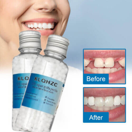 Dental restoration filling gel