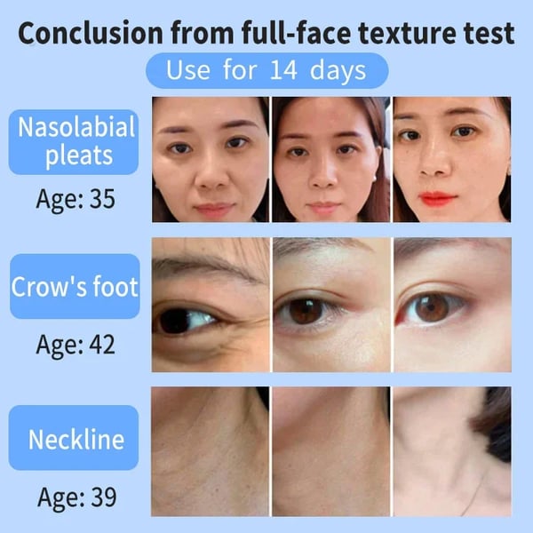 💕Last Day Promotion - 49% OFF💕Japanese Anti-wrinkle Rejuvenation Cream