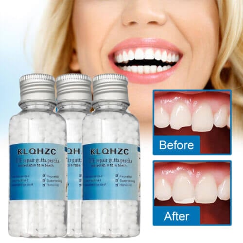 Dental restoration filling gel