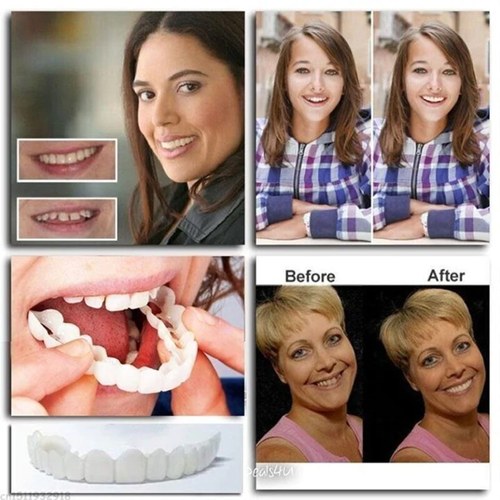 Sxcpouw™ Adjustable Snap-On Dentures🔥HOT SALE 48%🔥