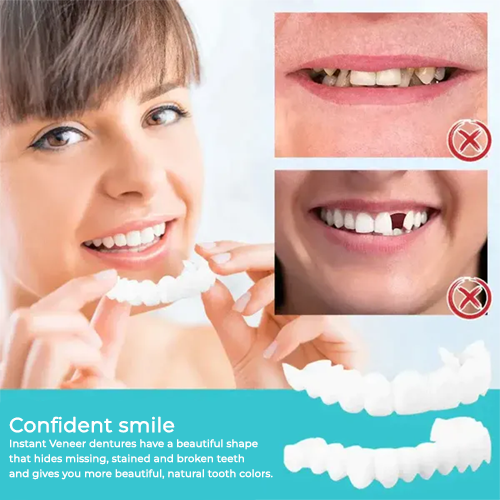 Sxcpouw™ Adjustable Snap-On Dentures🔥HOT SALE 48%🔥