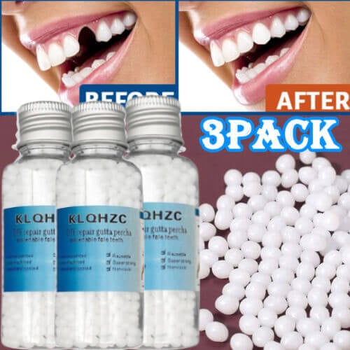 Dental restoration filling gel