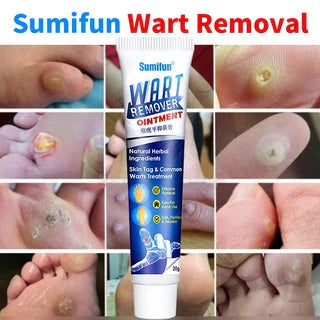 Herbal Wart Treatment Cream【3 Day Delivery&Cash on delivery】