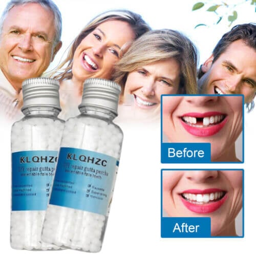 Dental restoration filling gel