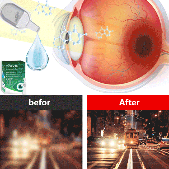 👨⚕👨⚕👨⚕Japan Old-Age Eye Drops🎉🎉🎉【HOT SALE-45%OFF🔥🔥🔥🔥🔥】