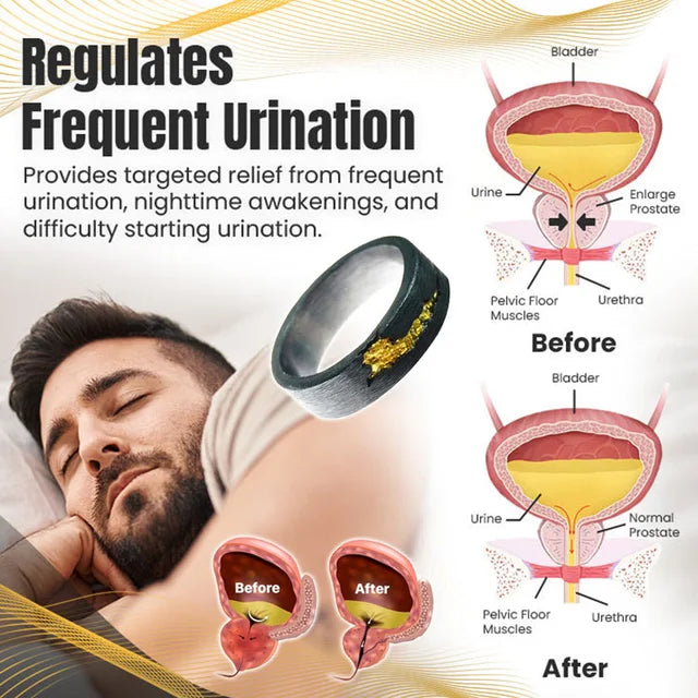 Relief Design Prostate Treatment Ring💪𝑀𝑎𝑑𝑒 𝑖𝑛 𝑡ℎ𝑒 𝑈𝑆𝐴⭐⭐⭐⭐⭐ - (5/5)