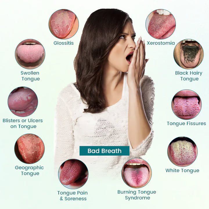 🔥 Special Deal: 70% OFF ⏰ CVREOZ® GlosShield Tongue Repair Spray 👅