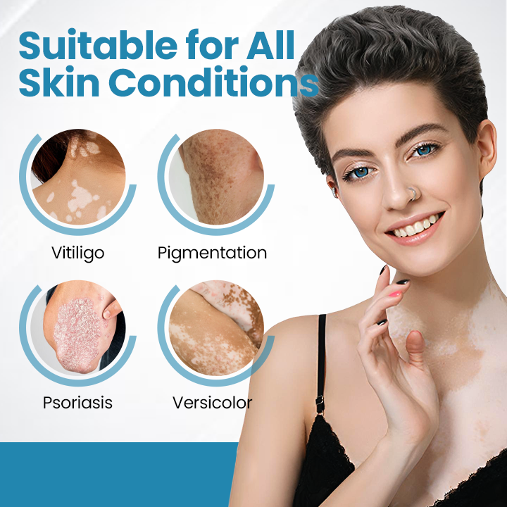 💥Bikenda® DermaBeam Vitiligo Therapy Device⏳Limited-time 48% off⏰💥