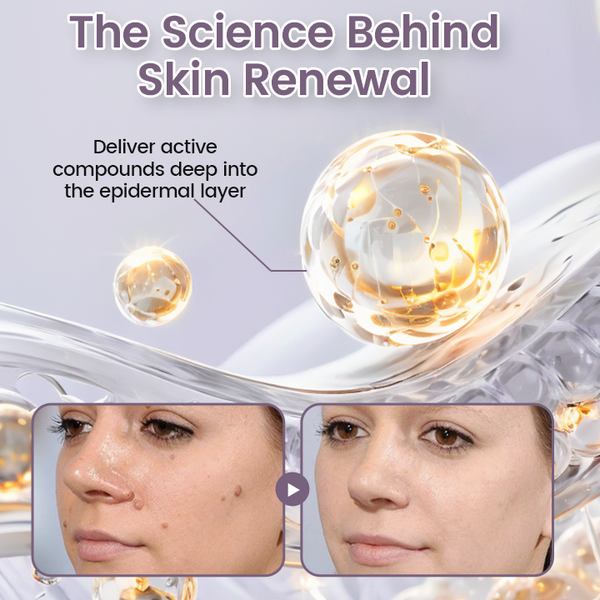 🔥Ceoerty® WartSmooth Renewal Serum🔥The FDA-Approved Solution🌟 Official Store