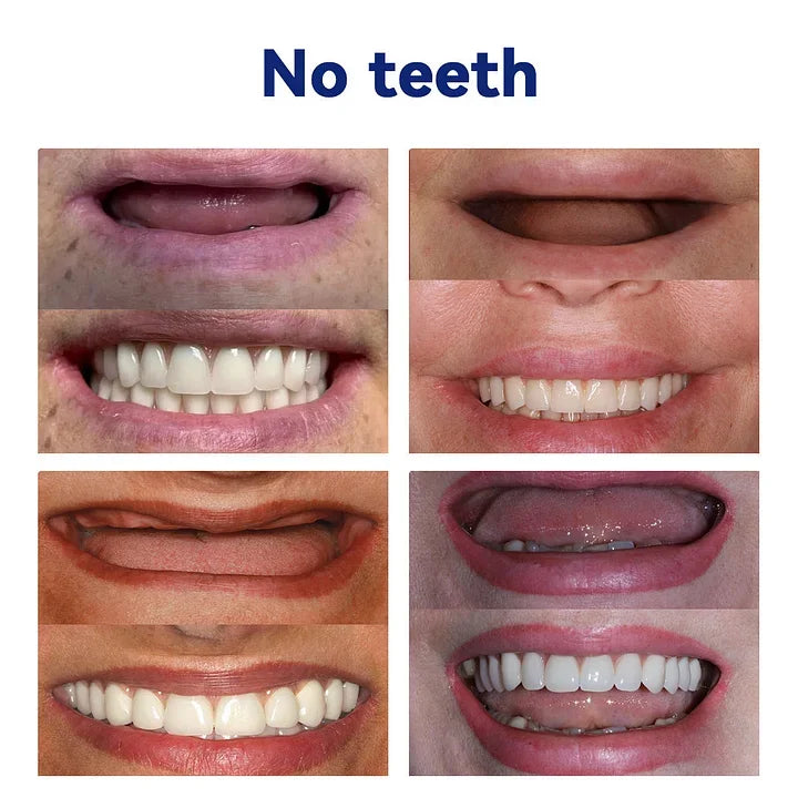 NESLEMY-🦷Advanced Customized Full Denture Set🦷 (⏰Limited time discount last 30 minutes⏰)