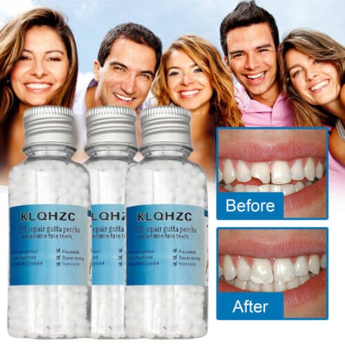Dental restoration filling gel