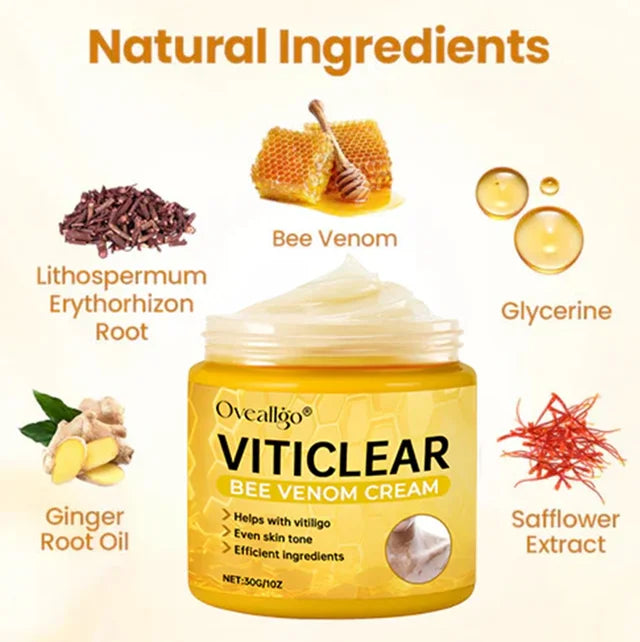 【🎌From japan🎌】Bee Venom Vitiligo Herbal Body Cream🔥LAST DAY Promotion 48% OFF🔥