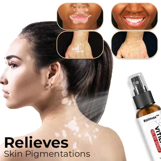 Kolmax™ VitiligoX Relief Spray (Limited Time Discount 50% OFF🔥 Last Day)