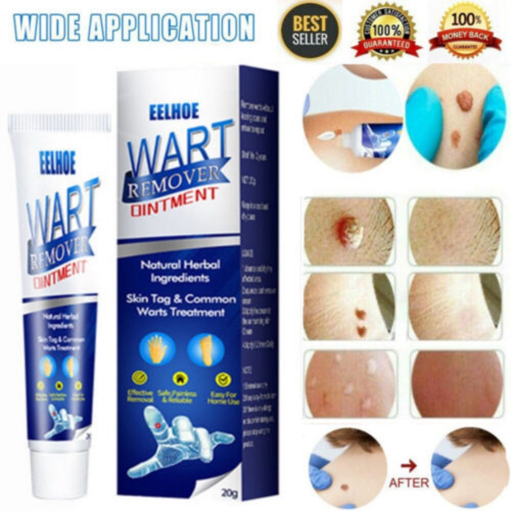 Herbal Wart Treatment Cream【3 Day Delivery&Cash on delivery】