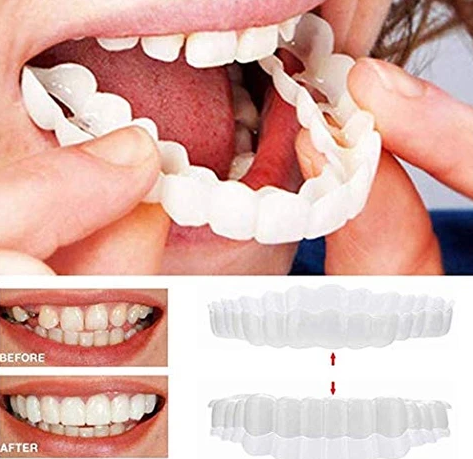 Magic Smile Teeth Brace 【Can eatting】100% non-inductive fit, no foreign body sensation!😁 (💥45% OFF) - 🔥HOT SALE🔥🎉