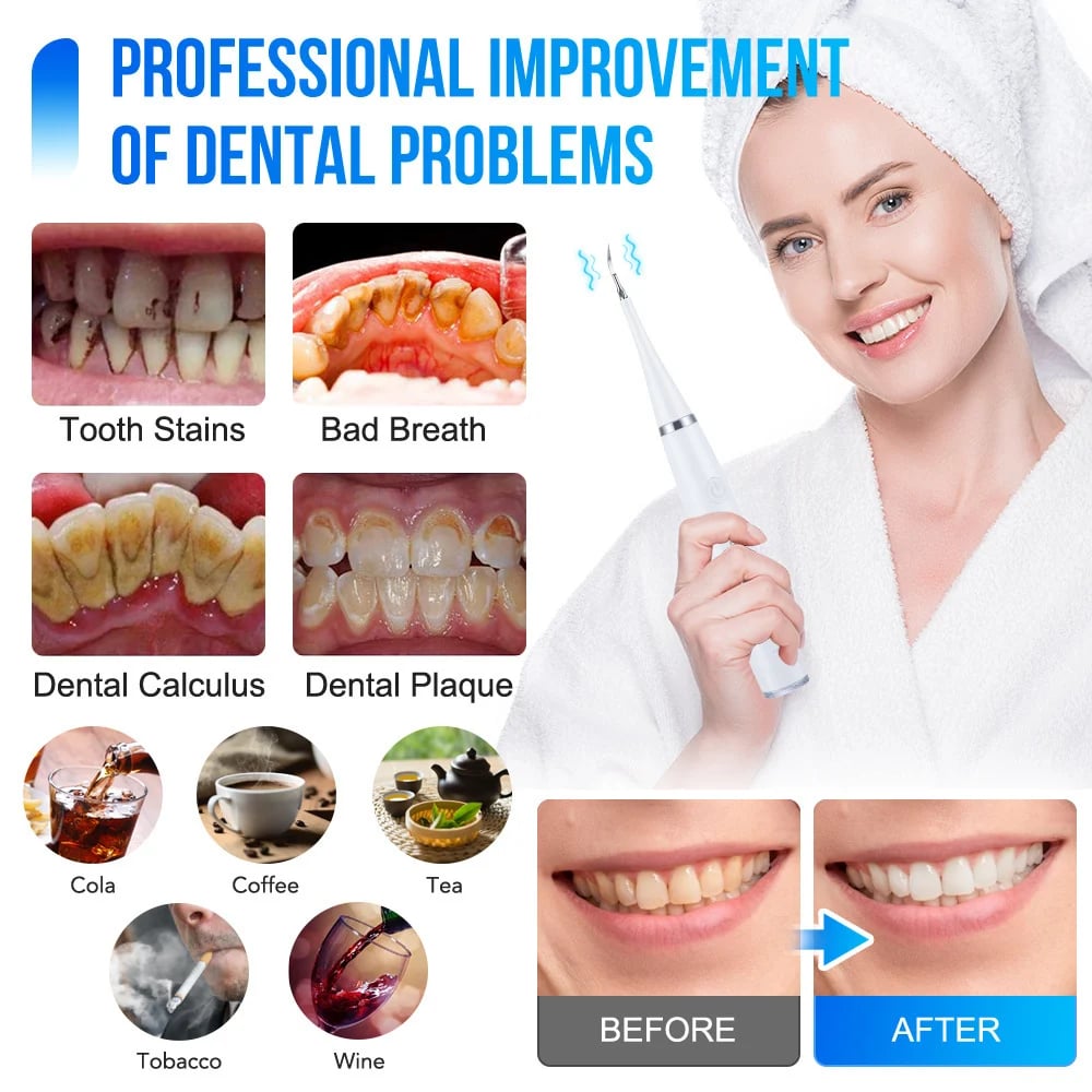 👨⚕🦷Electric tooth cleaning instrument -Teeth Cleaner
