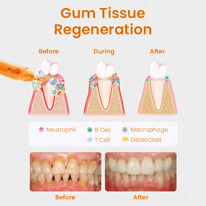 UnpreeTM Gum Repair Treatment Ampoules