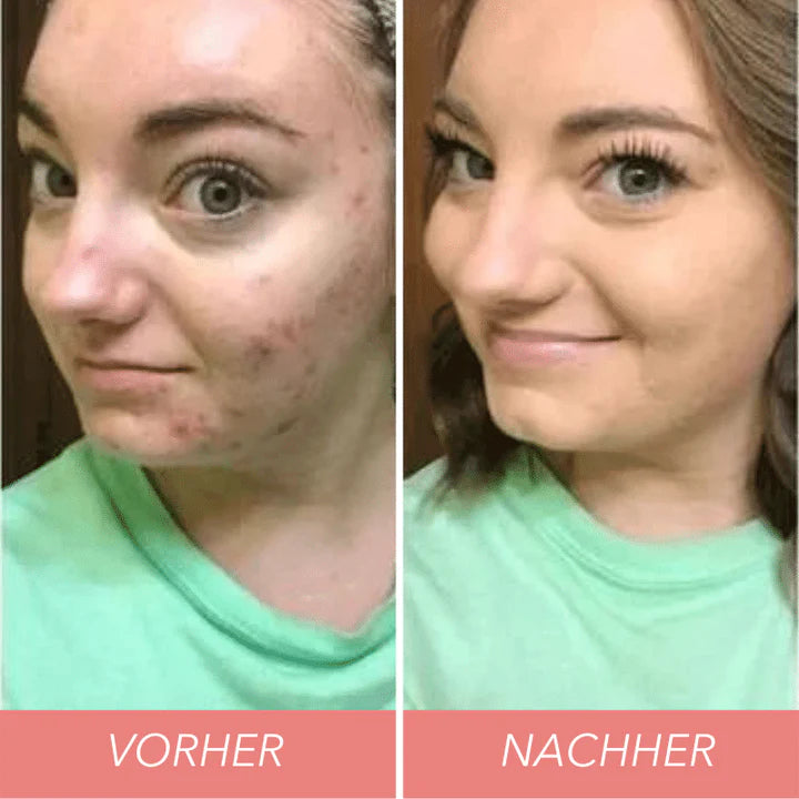 HeySmoothSkin™ - Tri-Color Concealer