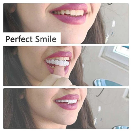 Magic Smile Teeth Brace 【Can eatting】100% non-inductive fit, no foreign body sensation!😁 (💥45% OFF) - 🔥HOT SALE🔥🎉