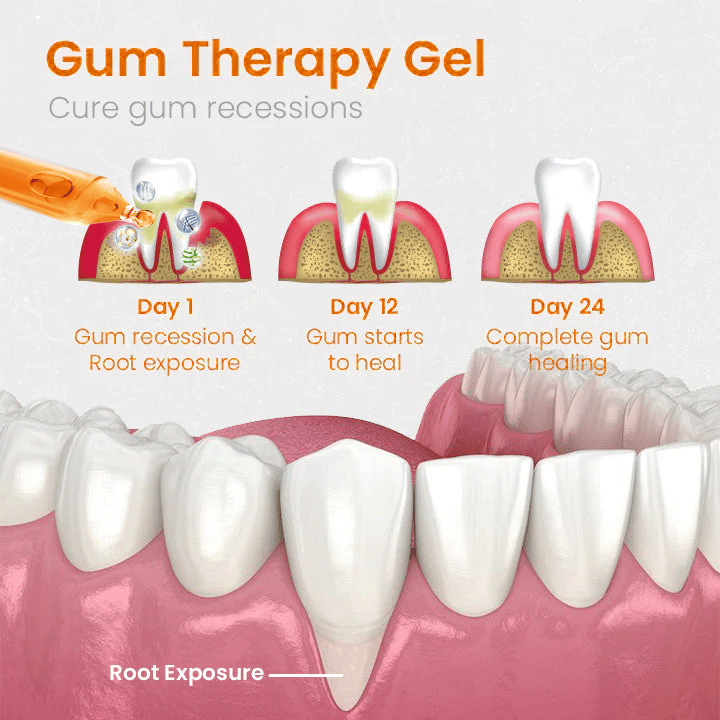 UnpreeTM Gum Repair Treatment Ampoules