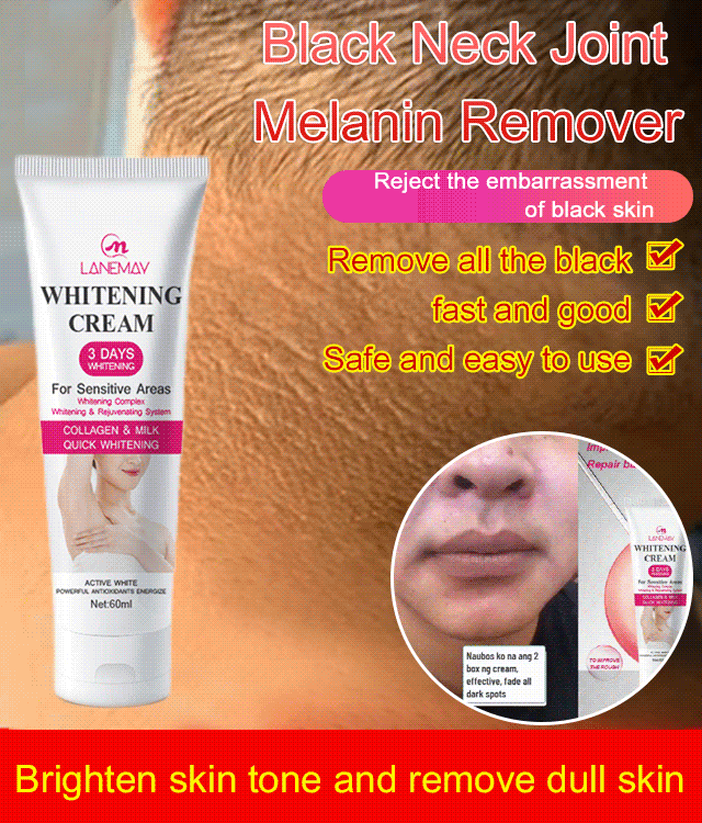 【🎌From japan🎌】Whitening spot cream【whole body whitening】⭐⭐⭐⭐⭐ - (5/5)