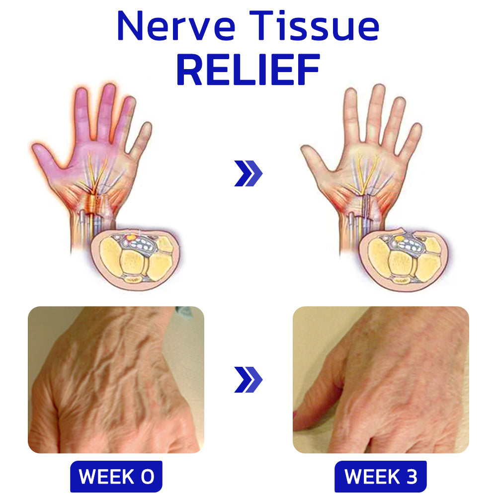 Sumifun™ Gout numbing ointment for hands and feet!