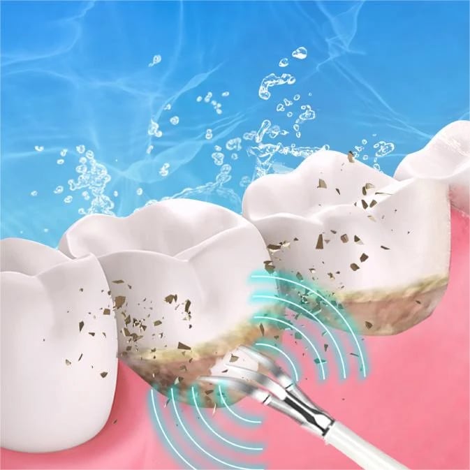 👨⚕🦷Electric tooth cleaning instrument -Teeth Cleaner