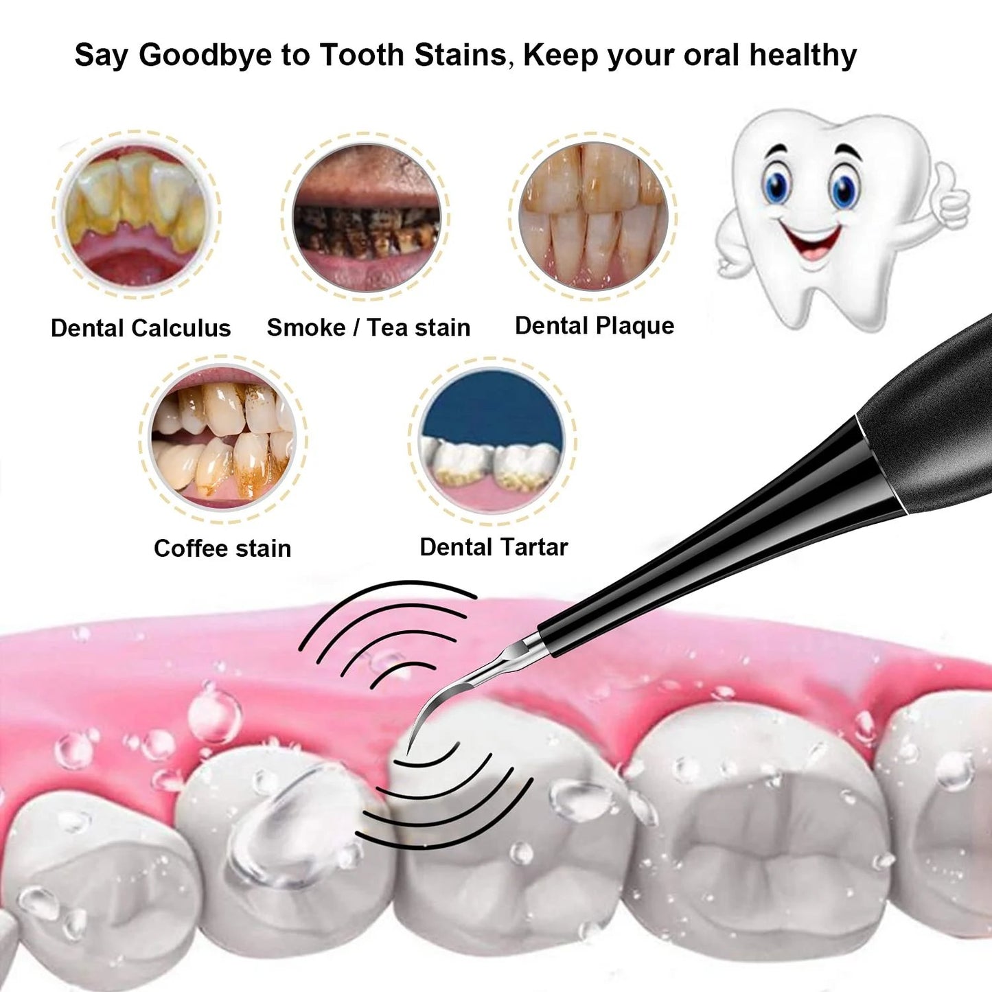 👨⚕🦷Electric tooth cleaning instrument -Teeth Cleaner