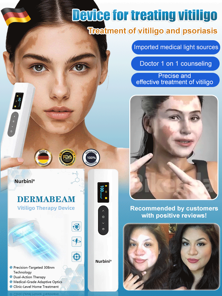 Nurbini® DermaBeam Vitiligo Therapy Device⏳Limited-time 49% off⏰💥