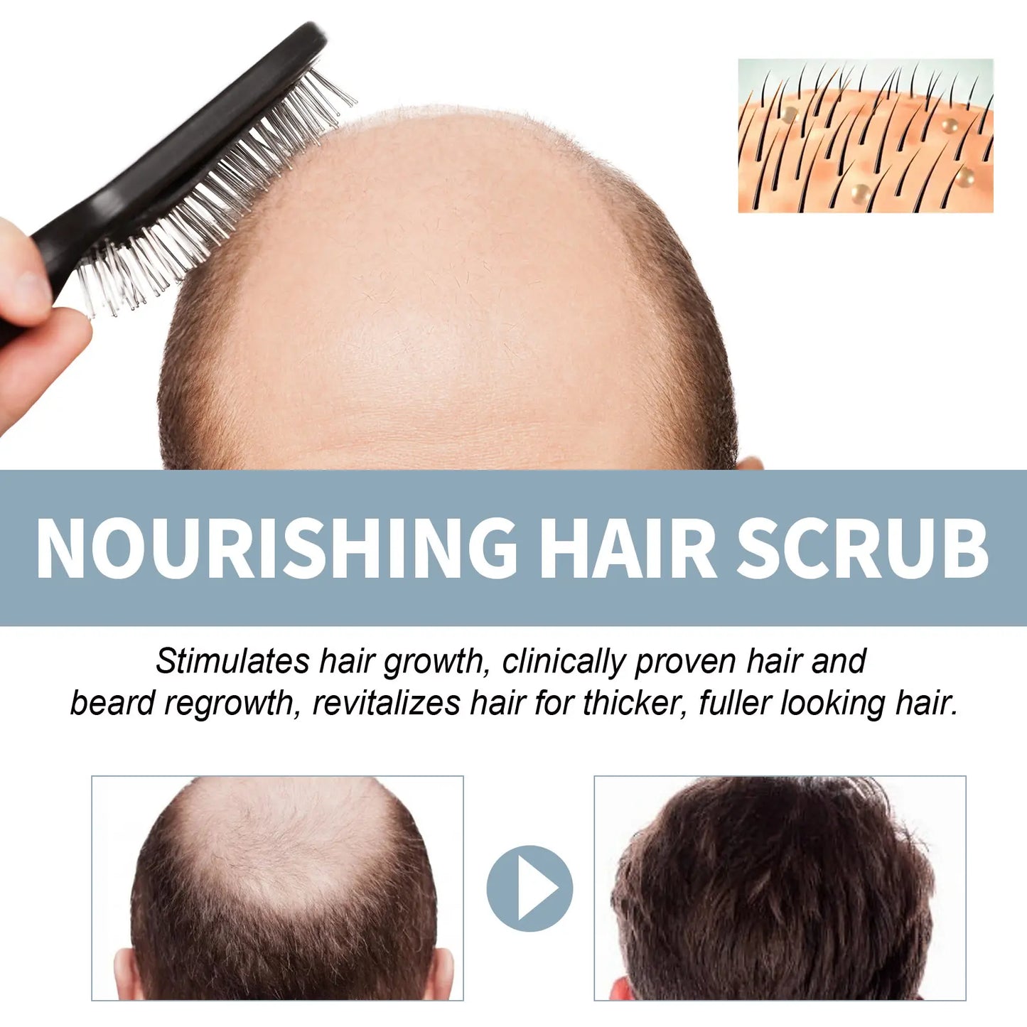 Sxcpouw™ Root Nourishing Hair Scrub🔥HOT SALE 48%🔥