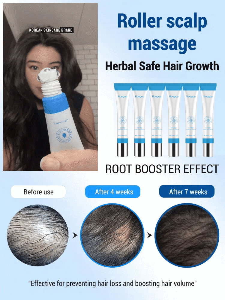 💥🇰🇷HAIR CARE ESSENCE ROLL-ON MADE IN KOREAN🇰🇷💥Best Selling 48% Off🔥