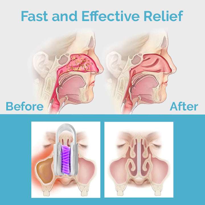 Sxcpouw™ MucusRelief Nasal Cleansing Device【🎌From japan🎌】