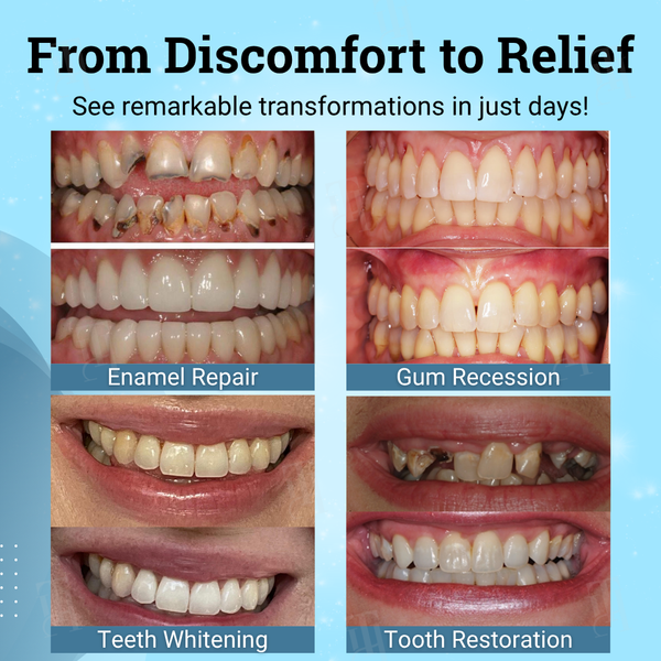 👨‍⚕️ Dentist's Choice : AEXZR® Non-Surgical Gum "Suture" Gel