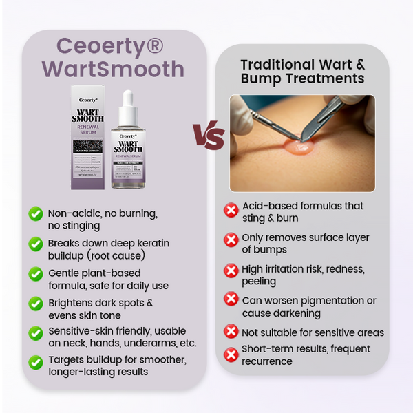 🔥Ceoerty® WartSmooth Renewal Serum🔥The FDA-Approved Solution🌟 Official Store