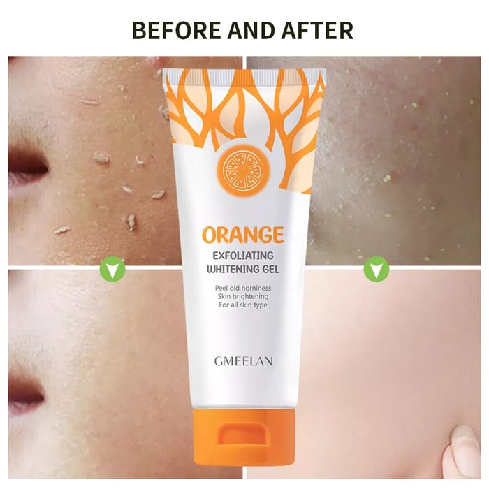 🔥Last Day Promotion 49% OFF🔥Orange Exfloliating Whitening Gel