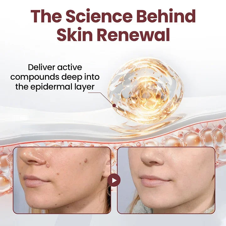 🔥Laozik®KeraErase Dual-Action Renewal Cream🔥The FDA-Approved Solution🌟 Official Store