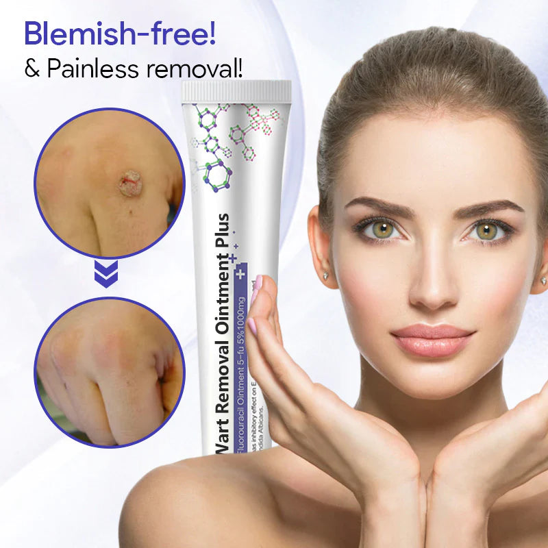 SkinRx™ Wart Removal Ointment Plus