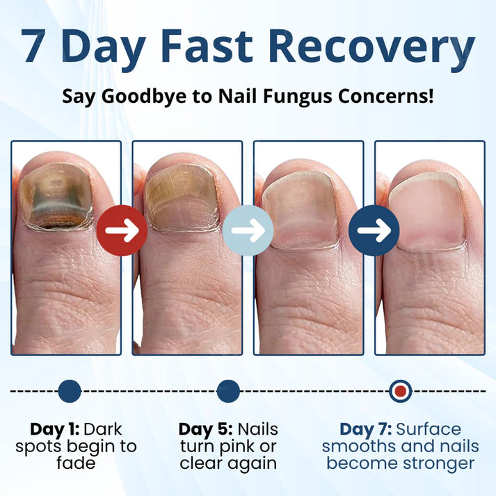 ⭐🎉Countdown to 2026: 60% OFF⭐🎉MycoShield Pro Fungal Nail Patches