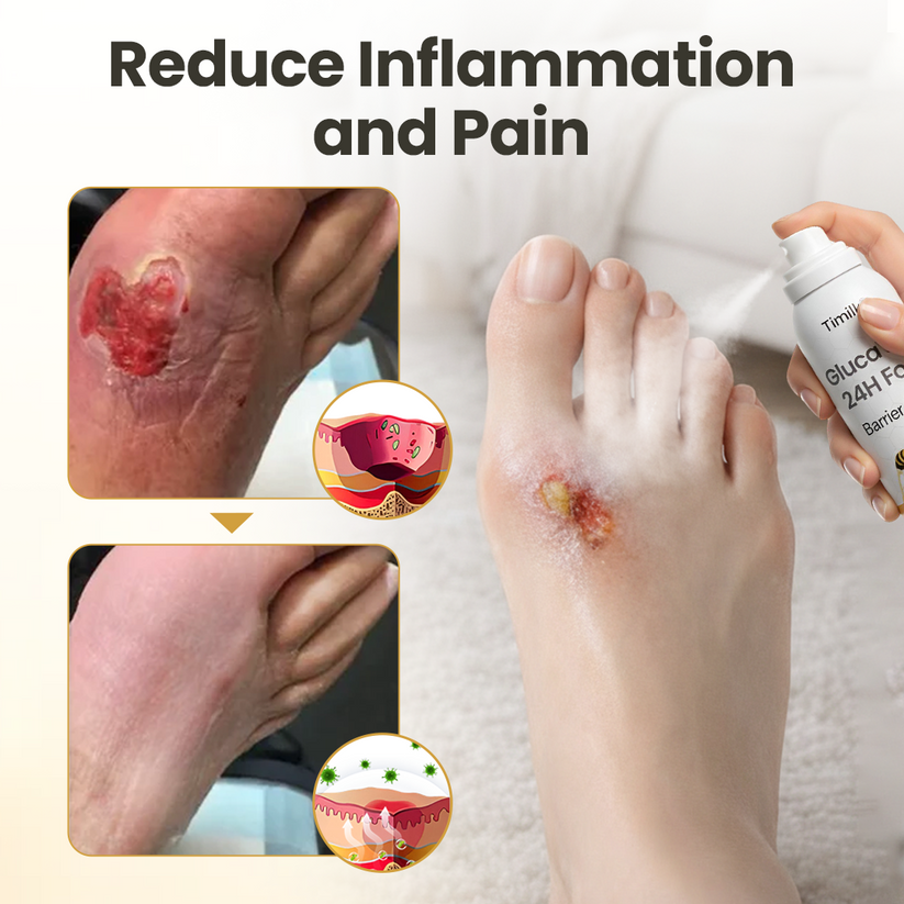 ⏳Limited-time 49% off⏰💥Timilk® GlucaVeil 24H Foot Barrier Spray