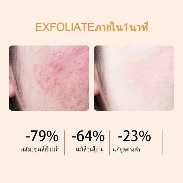 🔥Last Day Promotion 49% OFF🔥Orange Exfloliating Whitening Gel