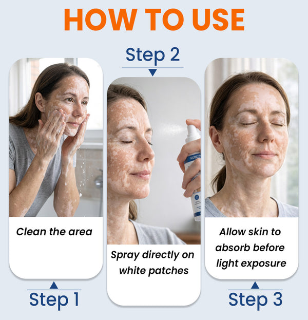 ⚡KUBOZN® Piperine Repigment Activator Spray to Reactivate Dormant Pigment Cells & Restore Natural Skin Color