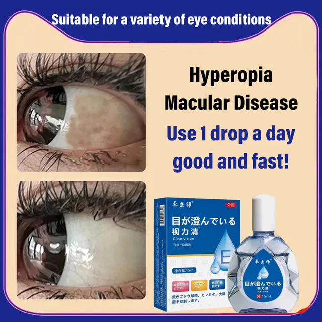 Anti-myopia/hyperopia Eye Drops【🎌From japan🎌】One bottle cures myopia/hyperopia!🔥