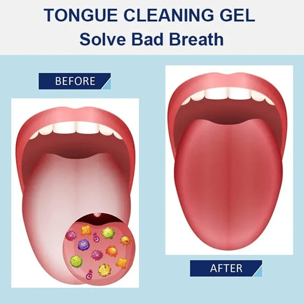 🔥2024 HOT Sale -Probiotic Tongue Cleaning Gel Set