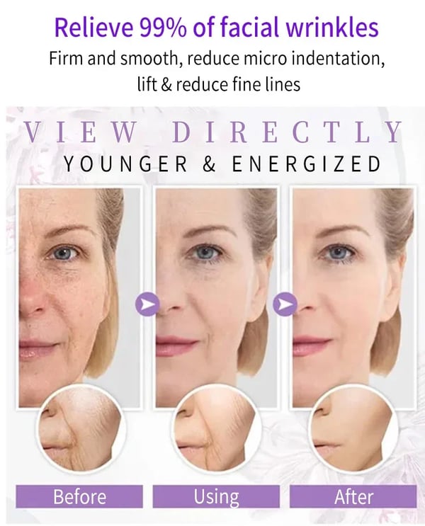 💕Last Day Promotion - 49% OFF💕Japanese Anti-wrinkle Rejuvenation Cream