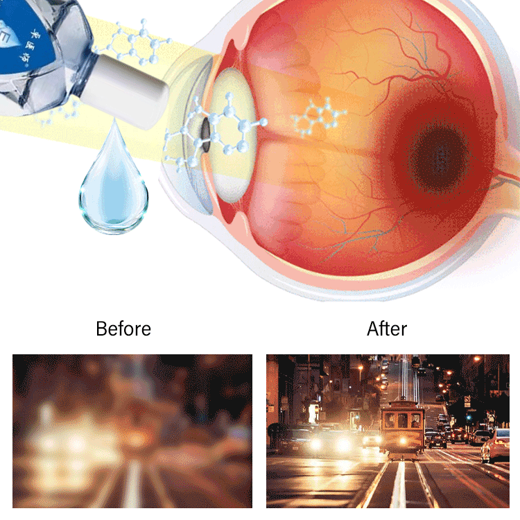 Anti-myopia/hyperopia Eye Drops【🎌From japan🎌】One bottle cures myopia/hyperopia!🔥