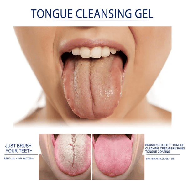 🔥2024 HOT Sale -Probiotic Tongue Cleaning Gel Set